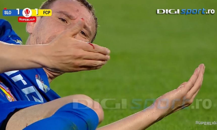 Controversă la Slobozia -a ”spart” fața, dar a scăpat de eliminare: ”Poate vom afla și explicațiile”