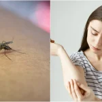 De ce nu e bine să ne scărpinăm după ce ne-a ciupit o insectă. Medicii vin cu explicații și trucuri pentru calmarea zonei