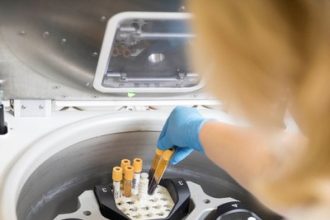 Adevărul din spatele bolilor rare: „Anii fără diagnostic nu sunt ani de pauză, sunt ani în care boala progresează”